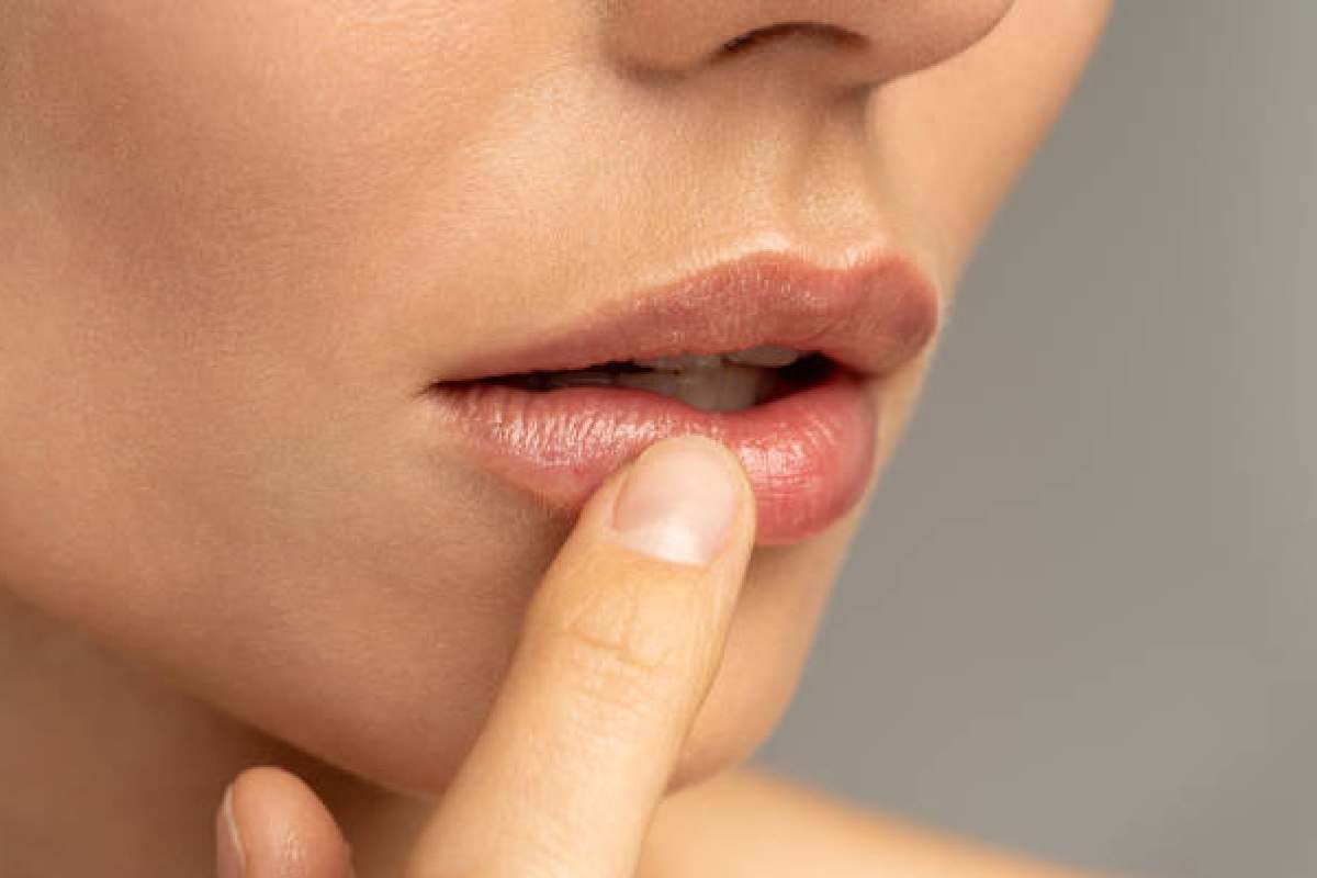 lip infection types with pictures