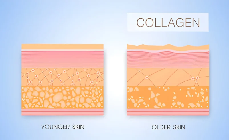 Does Collagen Actually Help Your Skin? What We Know About Collagen Supplements