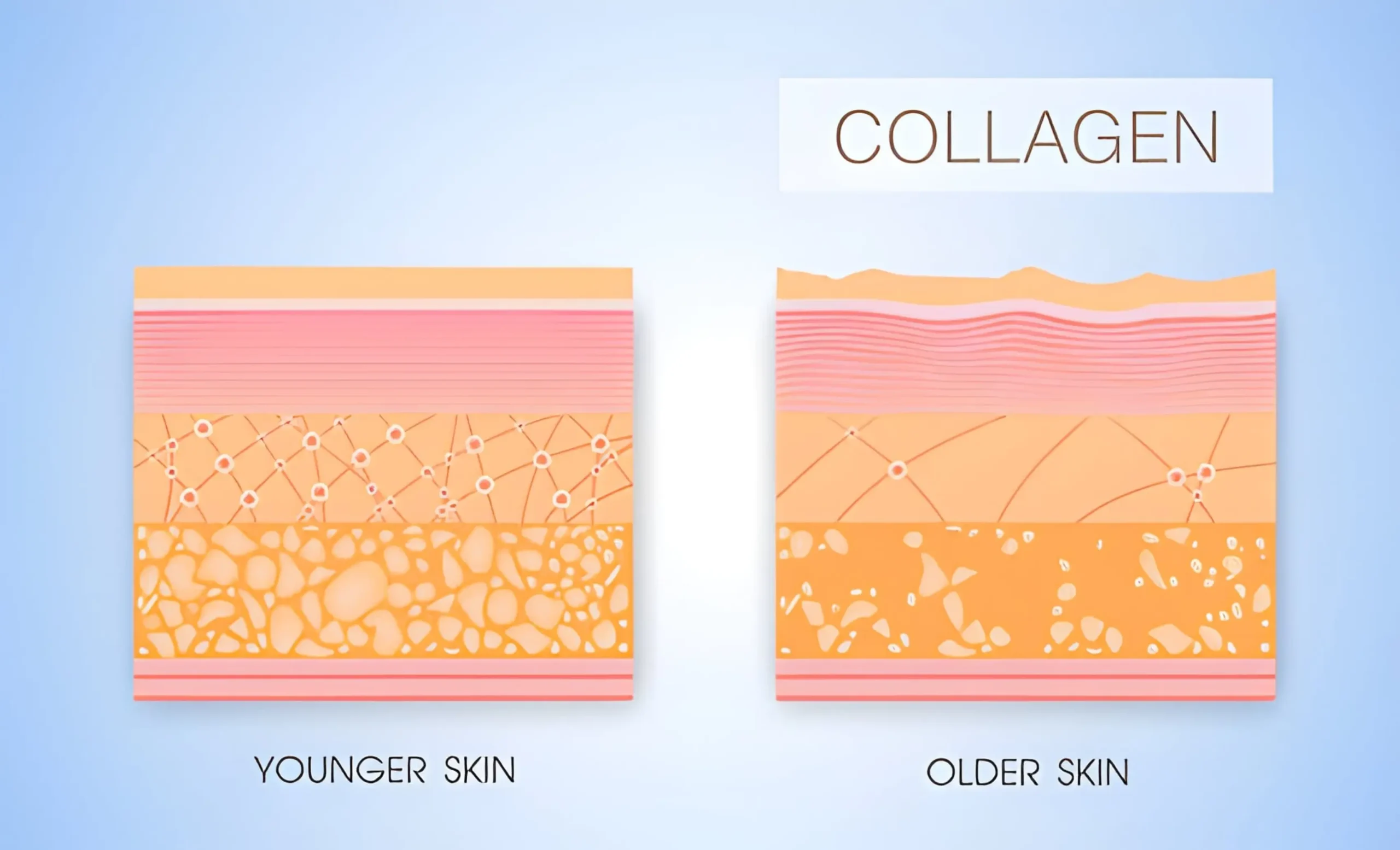 Does Collagen Actually Help Your Skin? What We Know About Collagen Supplements