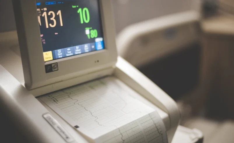 Irregular Heartbeat or Palpitations: When an ECG May Be Recommended