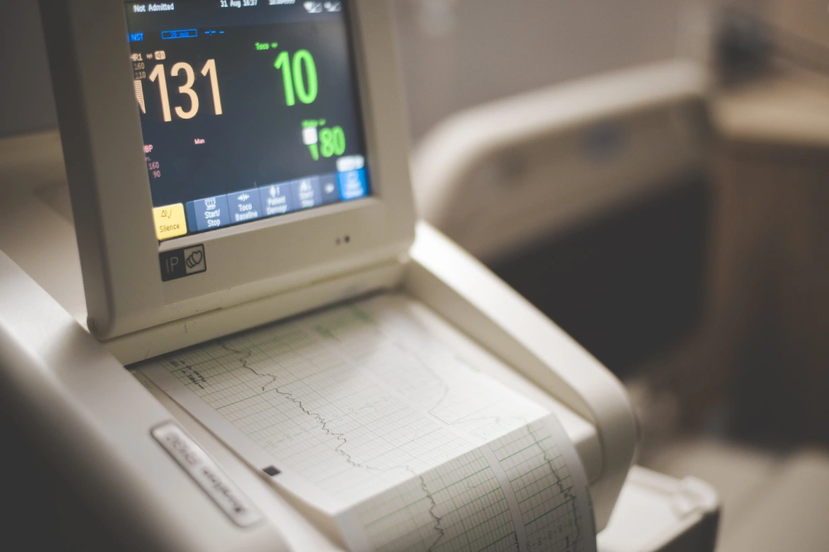 Irregular Heartbeat or Palpitations: When an ECG May Be Recommended